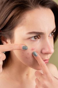 HOME Vrouw die laserontharing ondergaat als cosmetische behandeling ter verwijdering van ongewenst lichaamshaar